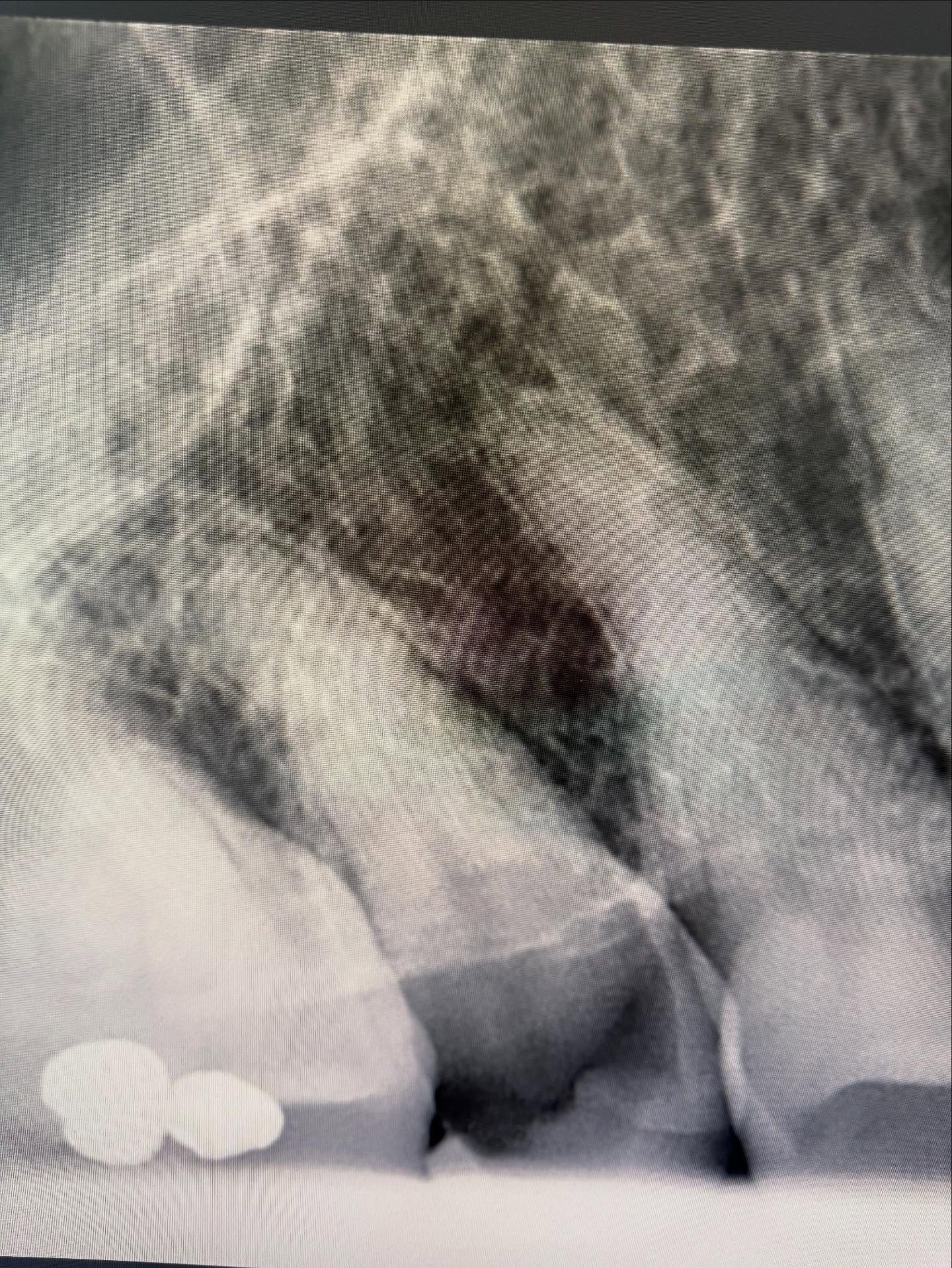 Bild från inlägget: Dagens implantat operation – bild 1